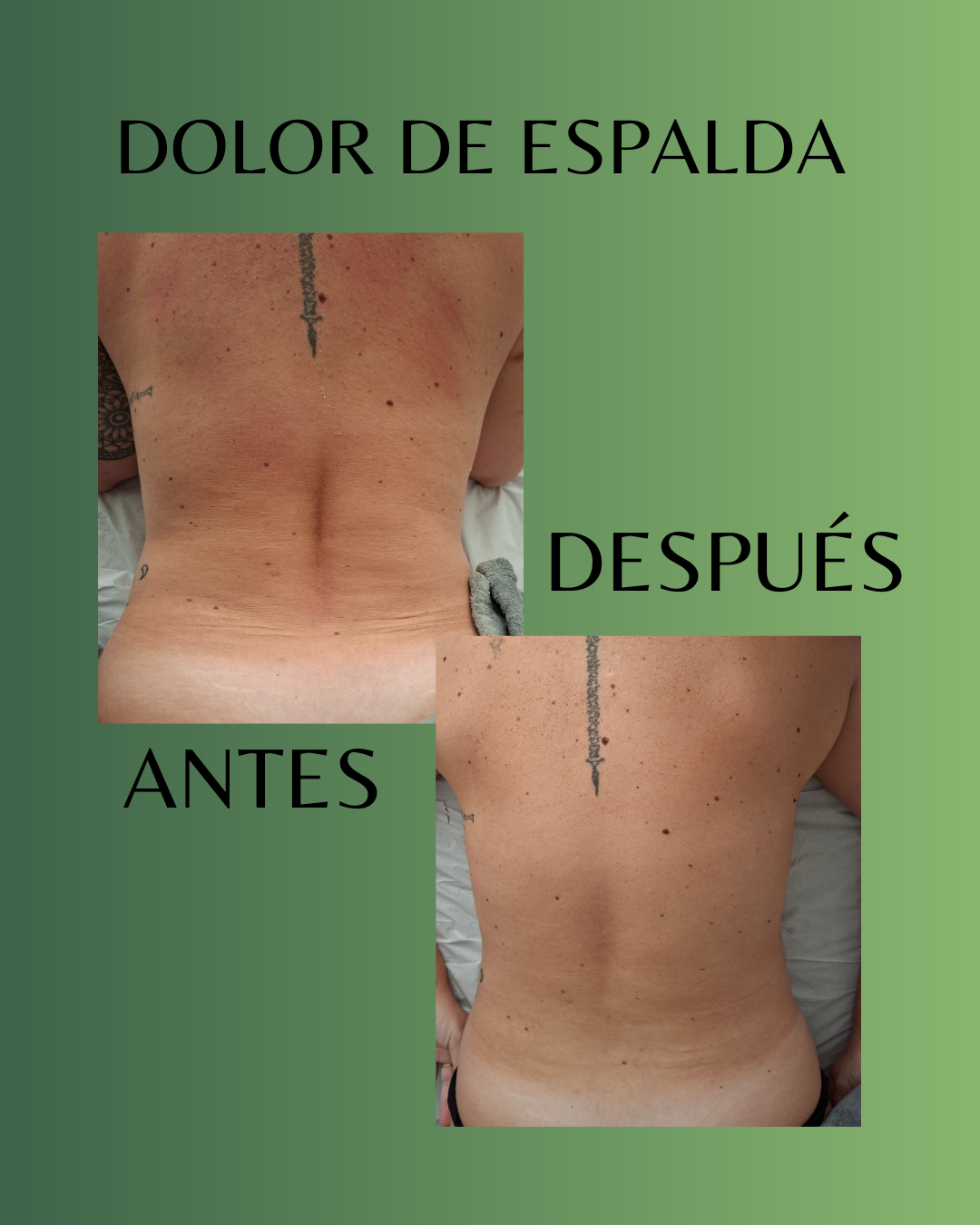 Resultado Antes y Después