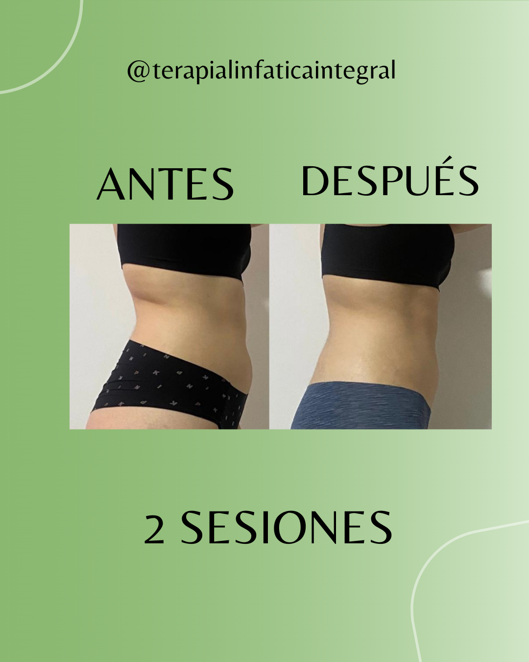 Resultado Antes y Después