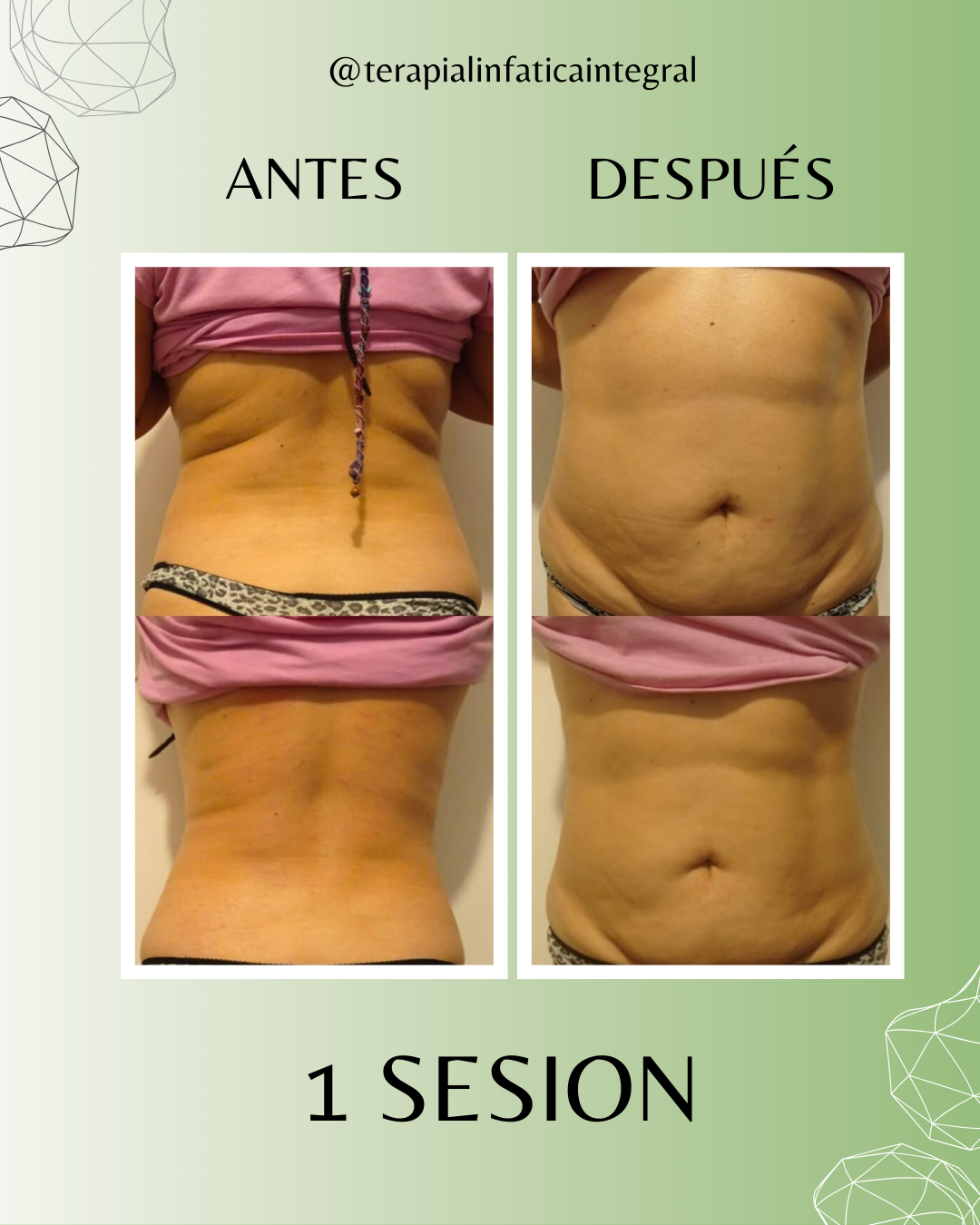 Resultado Antes y Después