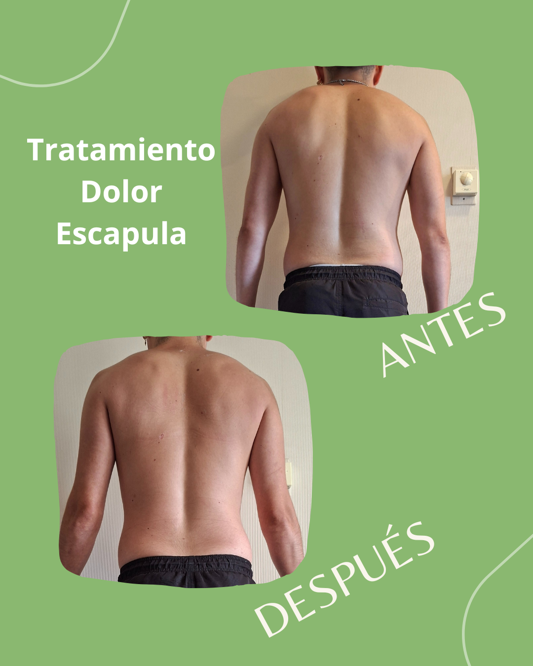 Resultado Antes y Después