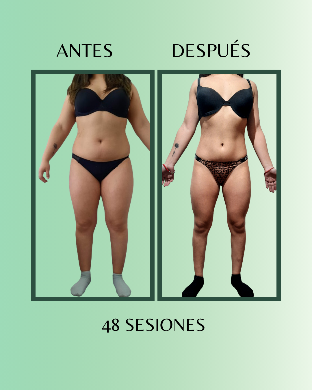 Resultado Antes y Después