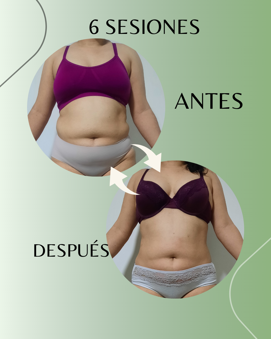 Resultado Antes y Después