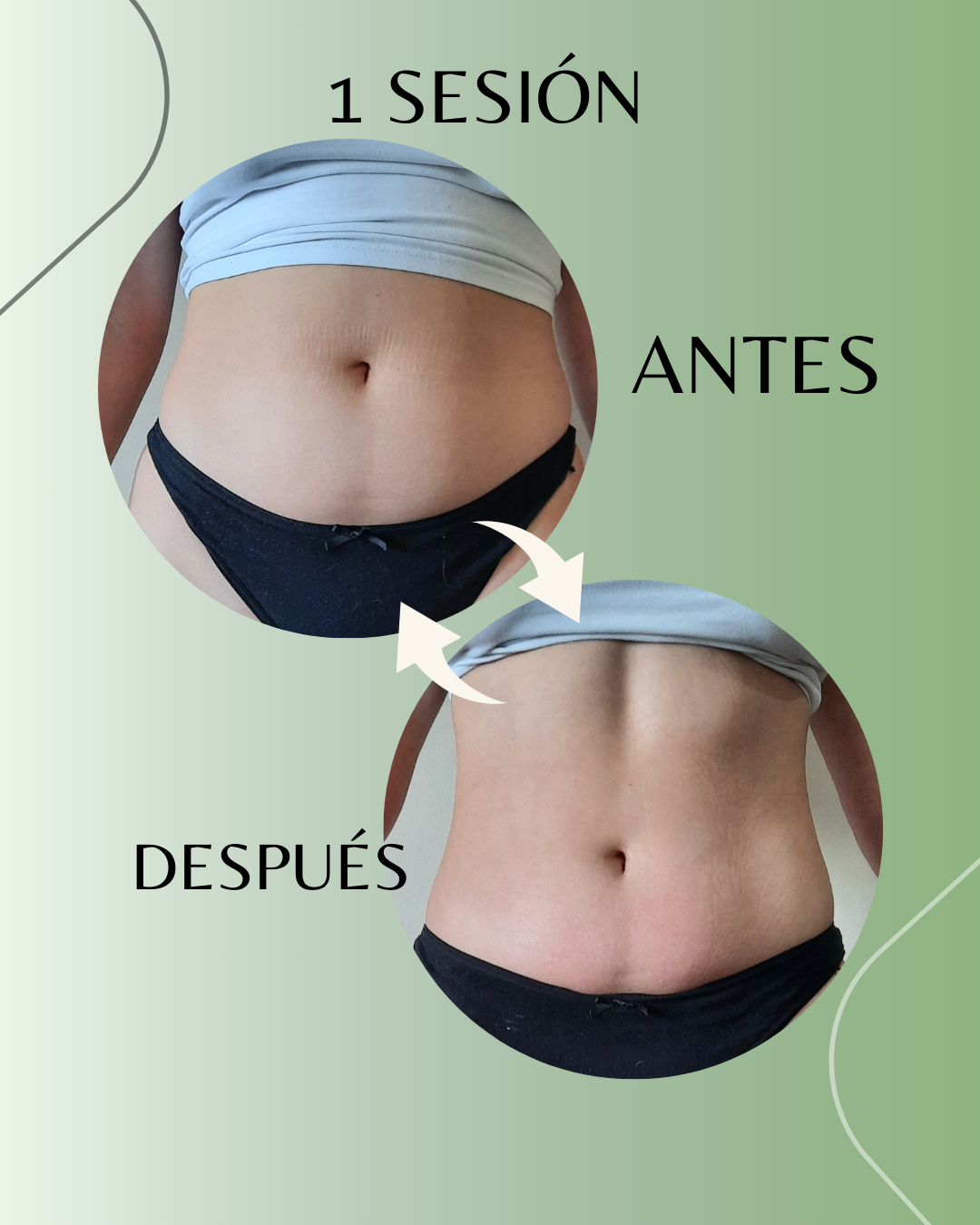 Resultado Antes y Después