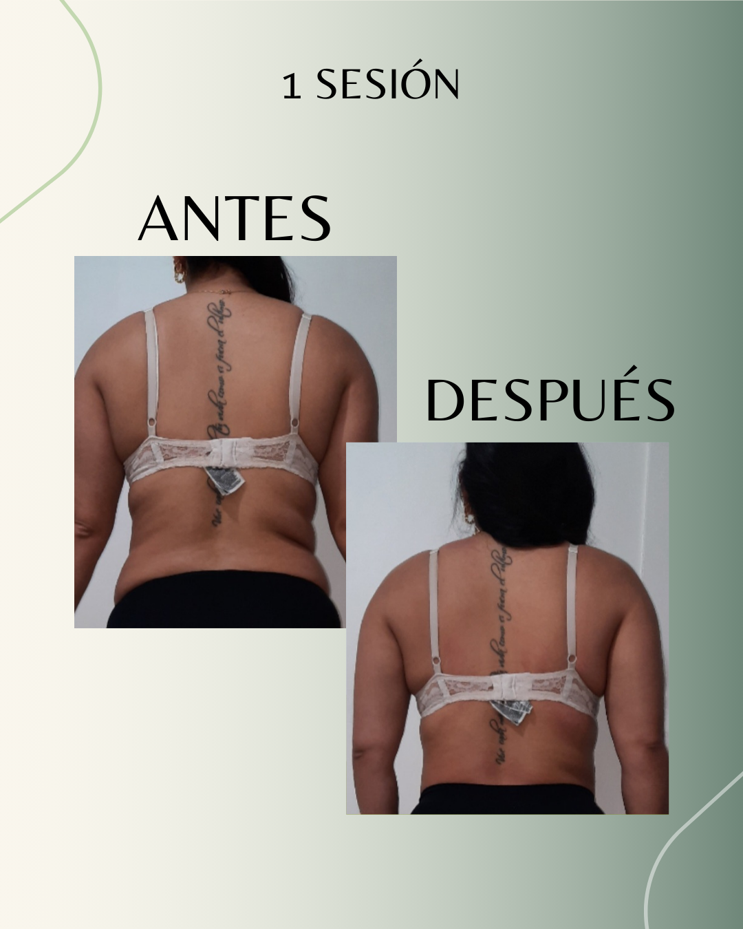 Resultado Antes y Después